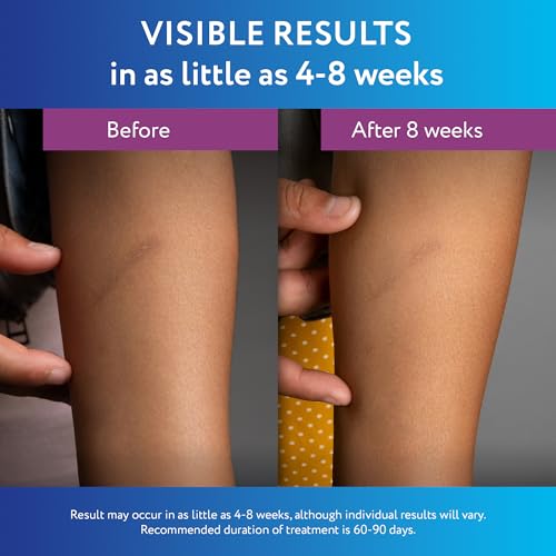 scaraway silicone scar gel helps improve size color amp texture of hypertrophic amp keloid scars from injury burns amp surgery water resistant 10g 035 oz