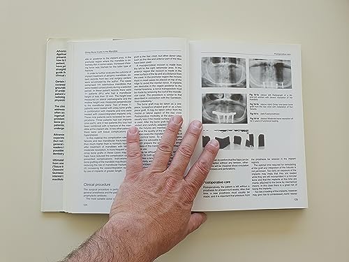 Advanced Osseointegration Surgery: Applications in the Maxillofacial Regions