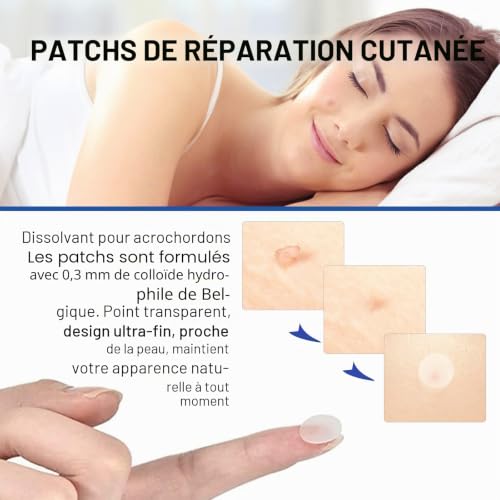 Kit d’enlèvement automatique de marques de peau Uocasi, efficace et indolore 2-en-1 pour marques de peau et molettes de petite à grande taille (1-9 mm), rapide et facile pour tous les types de peau – vue 9