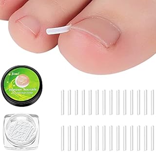 Wancala 20pcs Ingrown Toenail TreatmentandIngrown Toenail Corrector Kit,Ingrown Toenail Groove Ingrowing Toenail Patch Ingrown Toenail Tool Treament Women Foot Nail Care Tool,White