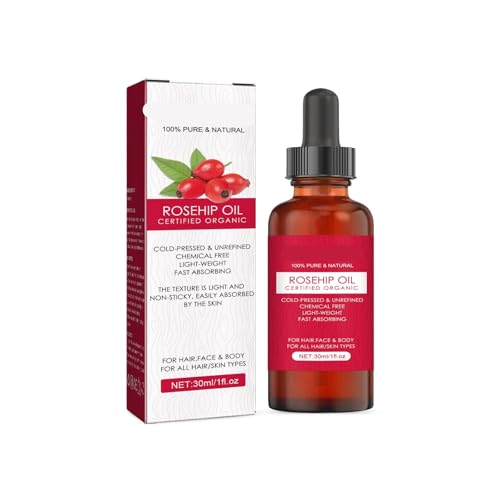Aceite Facial Y Corporal De Rosa Mosqueta: Hidratante, Nutritivo, Suavizante Y Capilar. Mejora La Sequedad, Equilibra La Grasa Y Mejora La Elasticidad.(1PCs)