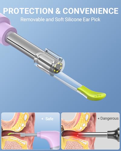 Image of ScopeAround Otoscope with Light, Ear Camera with Dual View, 720pHD WiFi Ear Scope with 6 LED Lights, 3.9mm Lens Otoscope Camera for Kids and Adults, Ear Scope Compatible w /iPhone and Android Pink