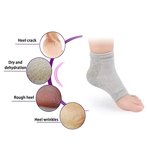 Dnhcll Soft Ventilate Gel Heel Socks, Gel Lined Toeless Spa Socks To Moisturize Dry Hard Cracked Skin And Soften Repair Feet (Gray) #TOP5