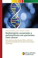 Radioinjuria Associada a Polimorfismo Em Pacientes Com Cancer 3639849078 Book Cover