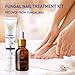 Toenail Fungus Treatment Extra Strength: Nail Fungus Treatment for Toenail and Fingernails - Fungus Nail Treatment Liquid 15ML and Anti-fungal Nail Repair Cream 20g Plant Extract Ingredients
