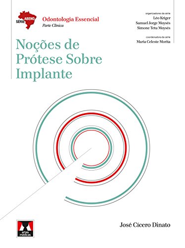 Noções de Prótese Sobre Implante