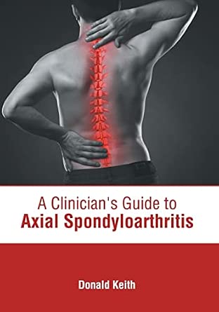 A Clinician's Guide to Axial Spondyloarthritis book cover