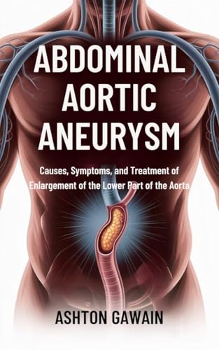 Abdominal Aortic Aneurysm : Causes, Symptoms, and Treatment of Enlargement of the Lower Part of the Aorta