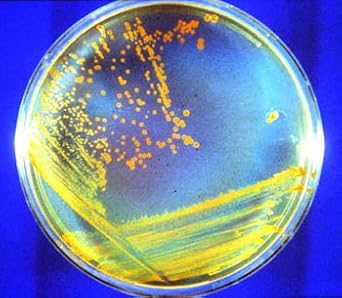 Tryptic Soy Agar (TSA) Prepared - 10, 100 Millimeter Plates