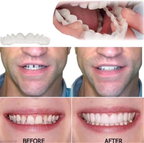 Image of Adjustable,Nature and Comfortable,Regain Confident Smile