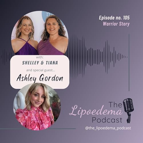 Couverture de Ep. 105 ~ Lipoedema Warrior Ashley Gordon