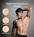 Ulike X Man IPL Hair Removal Device, Laser Hair Removal with Ice-Cooling, Dual Lights & SkinSenor for Nearly Painless & Long-Lasting Hair Removal, 3 Modes Tailored for Stubborn Hair, Gift Black