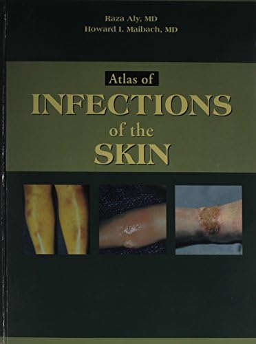 Buy Atlas of Infections of the Skin Book Online at Low Prices in India ...