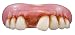 Billy Bob Teeth 147607 Billy-Bob Teeth- Puck Teeth