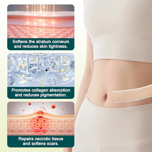 Cerotti Silicone Cicatrici, Rotolo Di Nastro In Cicatrici, Riutilizzabile Cerotti Silicone Scar,Riduzione E Schiarisce Cicatriziali,Tagliabile E Riutilizzabile(4Cm X 300Cm) - 3