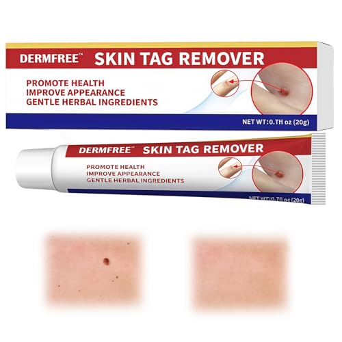 20g Crema para Imperfecciones de la Piel, Crema para el cuidado de la piel, Fácil De Usar，Manos y Cuerpo