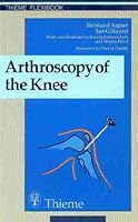Arthroscopy of the Knee 0865773424 Book Cover