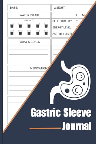 Gastric Sleeve Journal: Daily Bariatric Weight Loss Surgery Planner for Pre & Post Op | Complete Log Book With Meal Planner, Food Log, Water Intake ... Gastric Sleeve Gift For Women, Pocket Size