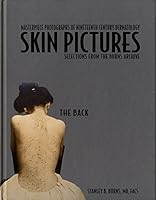 Photographic History of Nineteenth Century Dermatology: The Back 0974868892 Book Cover