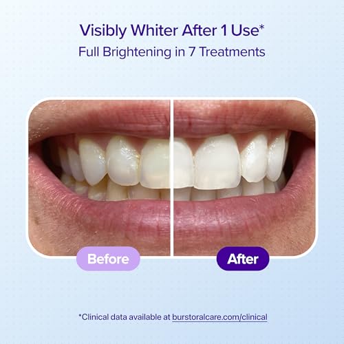 Image of BURST Sensitive Teeth Whitening Strips (Mint) | 20 Strips /10 Treatments - Each with 1 Upper /1 Lower | Visible Results in 15 Minutes | No-Slip Grip | Enamel-Safe Whitening Kit
