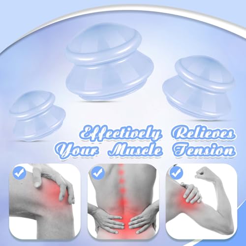 Image of TrelaCo 6 Pcs Silicone Cupping Kit for Massage Therapy,Light Blue | Cupping Cups 3 Sizes, Suction Therapy for Body Massage Myofascial, Relieves Cellulite Muscle Pain Tension, Studio Household