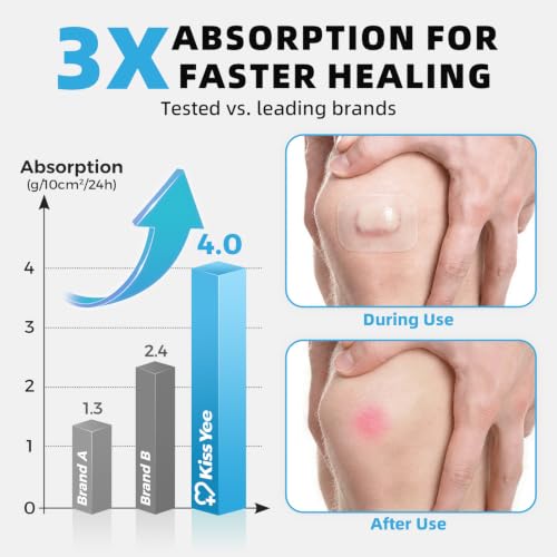 Image of Hydrocolloid Roll Bandages, 2IN x 5FT Extra Large Hydrocolloid Patch with Self-Adhesive, Ultra Absorbent, Cut-to-Size, Flexible & Waterproof for Burn, Blister, Acne Care, First Aid Kit Essential