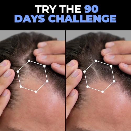 Image of Beardo Stress Buster Electric Scalp Massager + Dr. Beardo Advanced Hair Growth Serum | Stimulates Hair Growth, Relieves Stress | 3 Speed Modes, 120 min Runtime, 3% Redensyl & Baicapil | Hair Growth Combo for Men