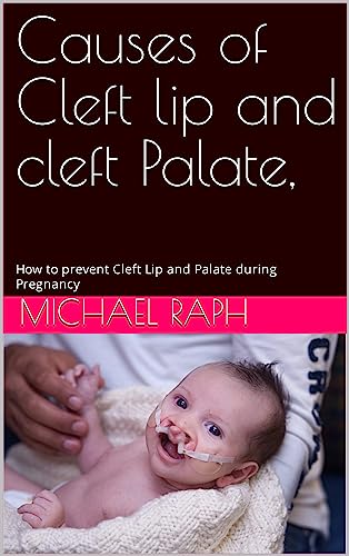 Causes of Cleft lip and cleft Palate,: How to prevent Cleft Lip and Palate during Pregnancy