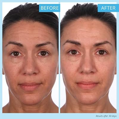SKINN Creme Reverse with Ferulic Acid, Retinol and Vitamin C-Creme Reverse Intensive-Anti-Aging Cream with Hyaluronic Acid to Plump Skin Vitamin C Help to Improving Tone, Firmness of Skin