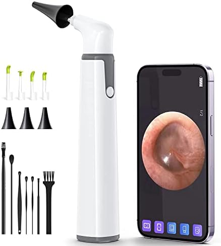 ScopeAround Wireless Otoscope Ear Cleaner Camera, Ear Wax Removal Kit Camera with 6 LED Lights, 3.9mm Visual Ear Scope for Kids, Adults & Pets, Compatible with Android/iPhone/iPad (White)