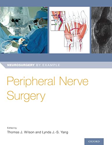 Peripheral Nerve Surgery (Neurosurgery By Example) #TOP24