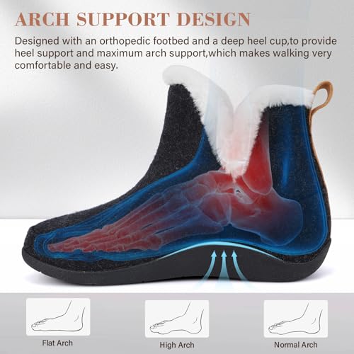 ERGOfoot Slipper Boots With Arch Support for Women Men, Comfy Plantar Fasciitis Orthopedic Slippers for Indoor Outdoor, Wool Felt Slipper Booties with Warm Cozy Plush Faux Fur Lining2