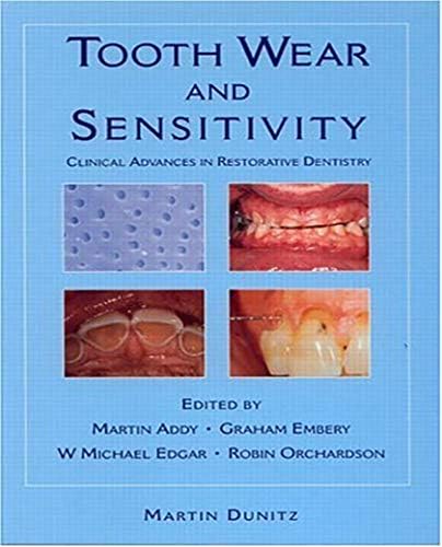 Tooth Wear and Sensitivity: Clinical Advances in Restorative Dentistry ...