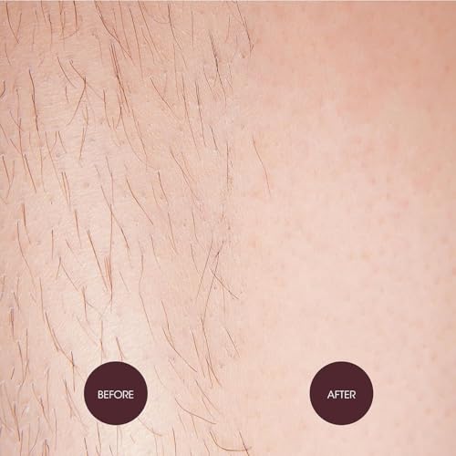 Image of Brazilian Stripless Painless Hair Removal Wax For Men & Women| Quick & Easy Tan Removal Waxing For Face, Armpit & Bikini Areas Wax Beans 100gm, Wax For Women (Wax, Waxing Combo)