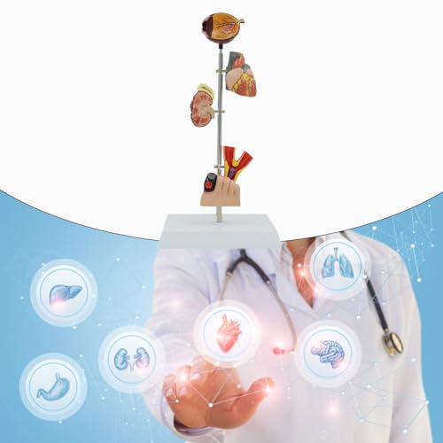 Modèle anatomique de pathologie rénale pour expliquer les lésions
