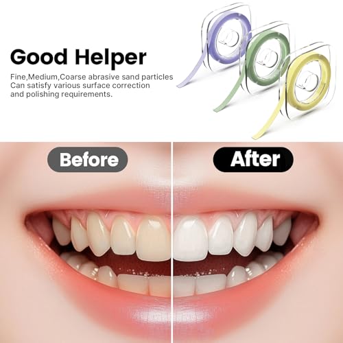 razoko dental polishing strips tooth file 3-variant set for dental sanding strips personalized care dental abrasive stripsdental sandpaper oral care grinding cleaning tool