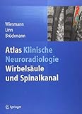 wiesmann catering  Atlas Klinische Neuroradiologie: Wirbelsäule und Spinalkanal