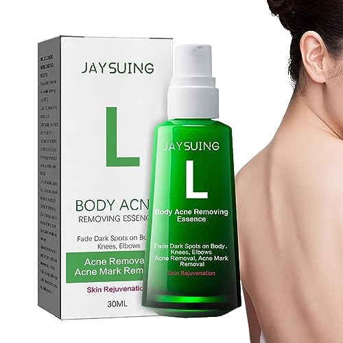 Sueros para manchas, Esencia reparadora de espinillas, Esencia de reparación de acné corporal de 30ml, productos de belleza corporal, esencia de reparación de espinillas para manchas de acné Sysdisen