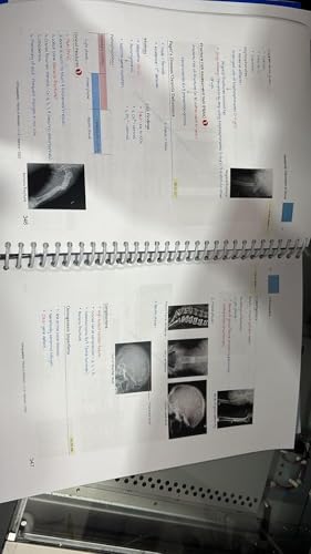 Image of World Rapid Revision marrow Notes 2025-26 - Ultimate Rapid Revision for NEET PG, FMGE & AIIMS