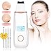Produktbild Olictar 5 in 1 Ultraschallpeelinggerät Mitesserentferner Ultraschall Gesichts Scrubber Schmerzlos Mitesser Entferner Gold (Gold-new)