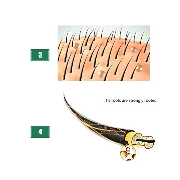 Hair-Growth-Oil2021-Hair-Growth-SerumHair-GrowthStops-Hair-Loss-Hair-Thinning-Treatment-Hair-Growth-TreatmentEssential-Oil-for-Women-Men-50ml Hair Growth Oil,2021 Hair Growth Serum,Hair Growth,Stops Hair Loss, Hair Thinning Treatment, Hair Growth Treatment,Essential Oil for Women Men-50ml…