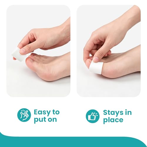 Image of Promifun Silicone Toe Protectors - 12 Pack Silicone Toe Sleeve for Hammer Toes, Corns, Calluses, Blisters - Soft Gel Toe Tube Pads for Pain Relief(Large Sizes, White)