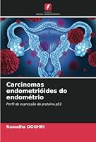Carcinomas endometrióides do endométrio 6205292483 Book Cover