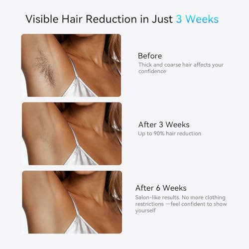 Image of Laser Hair Removal LIJAI IPL Hair Removal Device for Women & Men, 999,999 Flashes Painless Long-Lasting Results, at Home Hair Removal in 8mins for Armpits Legs Arms Bikini Line, Silver