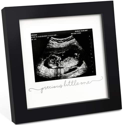 Image of KeaBabies Baby Sonogram Picture Frame - Modern Ultrasound Frame for Mom to Be, Pregnancy Announcement Sonogram Photo Frames, Gender Reveal for Expecting Parents,First Time Dad Gifts (Onyx Black)