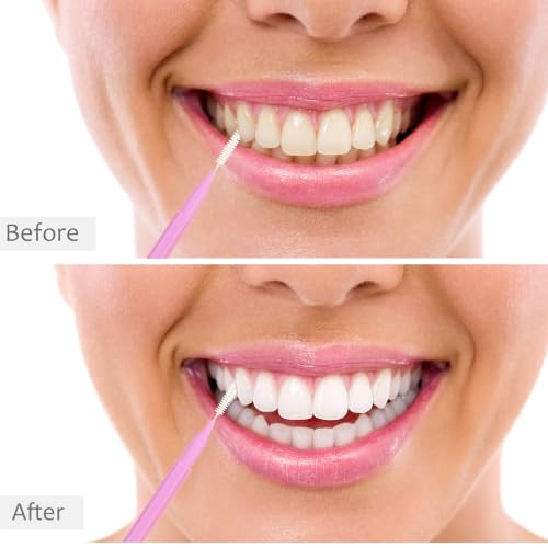 Image of Patelai 100 Pieces Braces Dental Brush for Cleaner Interdental Toothpick Dental Tooth Flossing Head Oral Hygiene Flosser Toothpick Cleaners Tooth Tool(Light Pink,Green,White,Mixed Size)