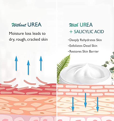 Urea 40% Foot Cream with 2% Plus Salicylic Acid, Foot Cream for Dry Cracked Heels - best Callus Remover For Feet & Hands… - Image 7