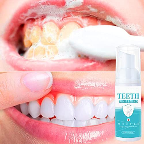 50Ml Saveuppro Teeth Whitening Mousse Foam Refreshing Breath Deep Cleaning Toothpaste, Fresh Breath, Travel Friendly, Easy To Use (1) (１) #TOP5