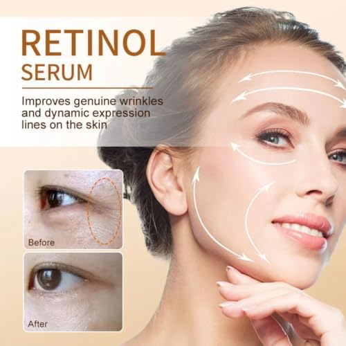 Retinol Serum for Face with Niacinamide & Vitamin C - Night Repair Face Serum for Fine Lines, Large Pores & Dullness - Ceramide Barrier Repair - 1 Fl Oz (30ml) — 사진 6