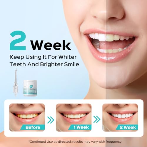Image of COSLUS Whitening Water Flosser Replacement Tips with 60 Pcs Mint Refills | Compatible with C20 (F5020E) & E40 (WFP14) Portable Water Flossers - Improve Stains Gently& Fresh Breath for Daily Oral Care